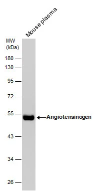 Mouse tissue extract (50 μg) was separated by 10% SDS-PAGE, and the membrane was blotted with Angiotensinogen antibody [N1C3] (GTX103824) diluted at 1:1000. The HRP-conjugated anti-rabbit IgG antibody (GTX213110-01) was used to detect the primary antibody.