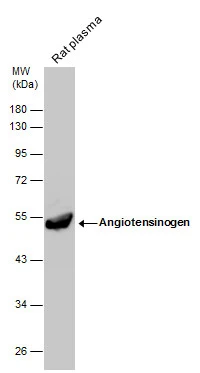 Rat tissue extract (50 μg) was separated by 10% SDS-PAGE, and the membrane was blotted with Angiotensinogen antibody [N1C3] (GTX103824) diluted at 1:1000. The HRP-conjugated anti-rabbit IgG antibody (GTX213110-01) was used to detect the primary antibody.