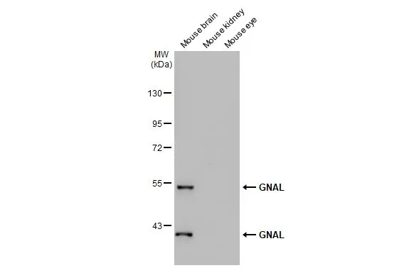Various tissue extracts (50 μg) were separated by 7.5% SDS-PAGE, and the membrane was blotted with GNAL antibody (GTX103863) diluted at 1:1000. The HRP-conjugated anti-rabbit IgG antibody (GTX213110-01) was used to detect the primary antibody.