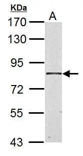 HSD17B4 antibody detects HSD17B4 protein by western blot analysis. A. 20 μg Rat heart lysate/extract 7.5% SDS-PAGE HSD17B4 antibody (GTX103864) dilution: 1:3000 The HRP-conjugated anti-rabbit IgG antibody (GTX213110-01) was used to detect the primary antibody.
