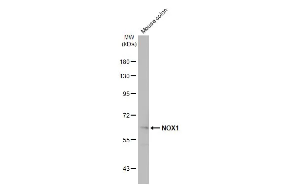 Mouse tissue extract (50 μg) was separated by 7.5% SDS-PAGE, and the membrane was blotted with NOX1 antibody (GTX103888) diluted at 1:2000. The HRP-conjugated anti-rabbit IgG antibody (GTX213110-01) was used to detect the primary antibody.