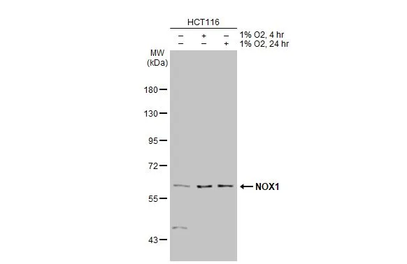 Untreated (–) and treated (+) HCT116 whole cell extracts (30 μg) were separated by 7.5% SDS-PAGE, and the membrane was blotted with NOX1 antibody (GTX103888) diluted at 1:2000. The HRP-conjugated anti-rabbit IgG antibody (GTX213110-01) was used to detect the primary antibody.