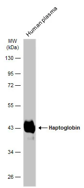 Human plasma (30 μg) was separated by 10% SDS-PAGE, and the membrane was blotted with Haptoglobin antibody (GTX103894) diluted at 1:30000. The HRP-conjugated anti-rabbit IgG antibody (GTX213110-01) was used to detect the primary antibody.