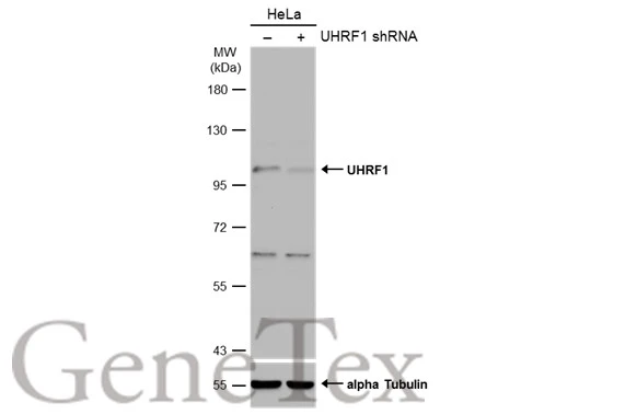 Non-transfected (–) and transfected (+) HeLa whole cell extracts (50 μg) were separated by 7.5% SDS-PAGE, and the membrane was blotted with UHRF1 antibody (GTX103925) diluted at 1:500. The HRP-conjugated anti-rabbit IgG antibody (GTX213110-01) was used to detect the primary antibody.