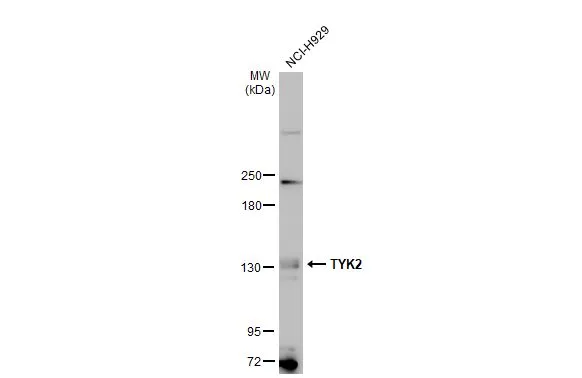 Whole cell extract (30 μg) was separated by 5% SDS-PAGE, and the membrane was blotted with TYK2 antibody [C1C3] (GTX103938) diluted at 1:500. The HRP-conjugated anti-rabbit IgG antibody (GTX213110-01) was used to detect the primary antibody, and the signal was developed with Trident ECL plus-Enhanced.