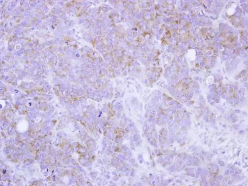 ST3GAL2 antibody [N2C3]
