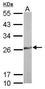 Sample (50 μg of whole cell lysate) A: Mouse liver 12% SDS PAGE GTX103943 diluted at 1:1000 The HRP-conjugated anti-rabbit IgG antibody (GTX213110-01) was used to detect the primary antibody.
