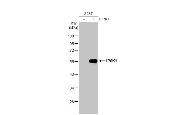 Non-transfected (–) and transfected (+) 293T whole cell extracts (30 μg) were separated by 10% SDS-PAGE, and the membrane was blotted with IP6K1 antibody (GTX103949) diluted at 1:5000. The HRP-conjugated anti-rabbit IgG antibody (GTX213110-01) was used to detect the primary antibody.