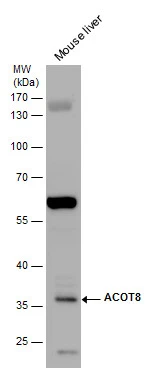 ACOT8 antibody detects ACOT8 protein by western blot analysis. Mouse tissue extracts (50 μg) was separated by 10 % SDS-PAGE, and the membrane was blotted with ACOT8 antibody (GTX103960) diluted by 1:1000. ACOT8 antibody detects ACOT8 protein by western blot analysis. Mouse tissue extracts (50 μg) was separated by 10 % SDS-PAGE, and the membrane was blotted with ACOT8 antibody (GTX103960) diluted by 1:1000.