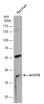 ACOT8 antibody detects ACOT8 protein by western blot analysis. Rat tissue extracts (50 μg) was separated by 10 % SDS-PAGE, and the membrane was blotted with ACOT8 antibody (GTX103960) diluted by 1:1000.