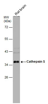 Rat tissue extract (50 μg) was separated by 10% SDS-PAGE, and the membrane was blotted with Cathepsin S antibody (GTX103988) diluted at 1:1000. Rat tissue extract (50 μg) was separated by 10% SDS-PAGE, and the membrane was blotted with Cathepsin S antibody (GTX103988) diluted at 1:1000.