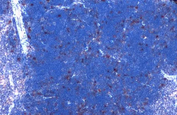CDK6 antibody [N1C3] detects CDK6 protein at nucleus by immunohistochemical analysis. Sample: Paraffin-embedded mouse thymus gland. CDK6 stained by CDK6 antibody [N1C3] (GTX103992) diluted at 1:1000. Antigen Retrieval: Citrate buffer, pH 6.0, 15 min