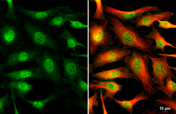 CDK6 antibody [N1C3] detects CDK6 protein at nucleus by immunofluorescent analysis. Sample: HeLa cells were fixed in 4% paraformaldehyde at RT for 15 min. Green: CDK6 stained by CDK6 antibody [N1C3] (GTX103992) diluted at 1:500. Red: alpha Tubulin, a cytoskeleton marker, stained by alpha Tubulin antibody [GT114] (GTX628802) diluted at 1:1000. Scale bar= 10μm.