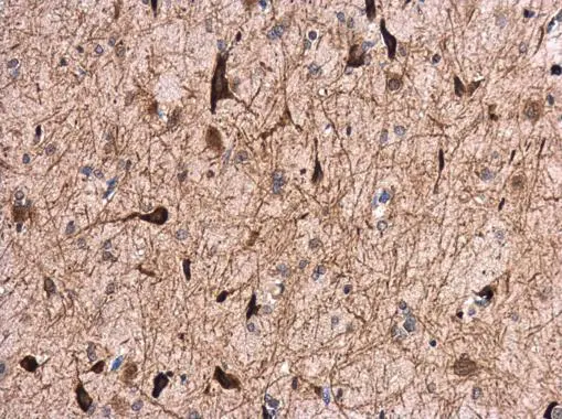 GABA A Receptor alpha 1 antibody [N1C1] detects GABA A Receptor alpha 1 protein at cytoplasm in rat brain by immunohistochemical analysis. Sample: Paraffin-embedded rat brain. GABA A Receptor alpha 1 antibody [N1C1] (GTX104027) diluted at 1:500. 
 Antigen Retrieval: Citrate buffer, pH 6.0, 15 min