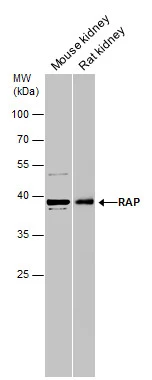 Various tissue extracts (50 μg) were separated by 10% SDS-PAGE, and the membrane was blotted with RAP antibody [N1C3] (GTX104033) diluted at 1:1000.