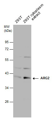 293T whole cell and cytoplasm extracts (30 μg) were separated by 10% SDS-PAGE, and the membrane was blotted with ARG2 antibody (GTX104036) diluted at 1:1000. The HRP-conjugated anti-rabbit IgG antibody (GTX213110-01) was used to detect the primary antibody.