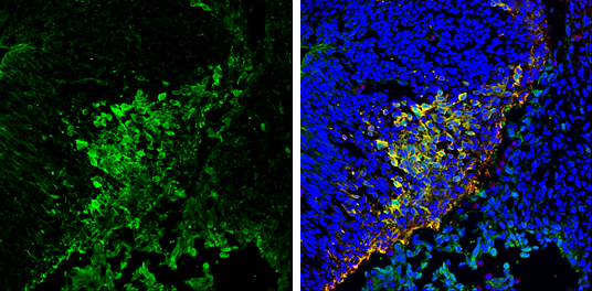 PGP9.5 antibody detects PGP9.5 protein expression by immunohistochemical analysis.