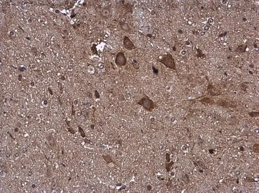 Pyruvate Dehydrogenase E1 beta subunit antibody detects Pyruvate Dehydrogenase E1 beta subunit protein at cytoplasm in mouse brain by immunohistochemical analysis. Sample: Paraffin-embedded mouse brain. Pyruvate Dehydrogenase E1 beta subunit antibody (GTX104040) diluted at 1:500. 
 Antigen Retrieval: Citrate buffer, pH 6.0, 15 min