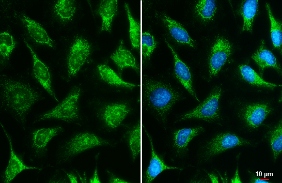 IDH3A antibody detects IDH3A protein at mitochondria by immunofluorescent analysis. Sample: HeLa cells were fixed in ice-cold MeOH for 5 min. Green: IDH3A stained by IDH3A antibody (GTX104073) diluted at 1:500. Blue: Hoechst 33342 staining. Scale bar= 10 μm.