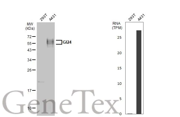 Various whole cell extracts (30 μg) were separated by 12% SDS-PAGE, and the membrane was blotted with GI24 antibody (GTX104081) diluted at 1:1000. The HRP-conjugated anti-rabbit IgG antibody (GTX213110-01) was used to detect the primary antibody. Corresponding RNA expression data for the same cell lines are based on Human Protein Atlas program.
