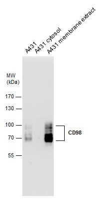 SLC3A2 antibody detects SLC3A2 protein by Western blot analysis. A431 whole cell extracts, A431 cytosol and A431 membrane extract (30 μg) were separated by 7.5% SDS-PAGE, and the membrane was blotted with SLC3A2 antibody (GTX104108) diluted at 1:500. SLC3A2 antibody detects SLC3A2 protein by Western blot analysis. A431 whole cell extracts, A431 cytosol and A431 membrane extract (30 μg) were separated by 7.5% SDS-PAGE, and the membrane was blotted with SLC3A2 antibody (GTX104108) diluted at 1:500.