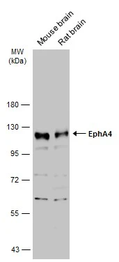 Various tissue extracts (50 μg) were separated by 7.5% SDS-PAGE, and the membrane was blotted with EphA4 antibody (GTX104109) diluted at 1:1000. The HRP-conjugated anti-rabbit IgG antibody (GTX213110-01) was used to detect the primary antibody.