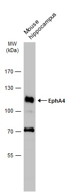 Mouse tissue extract (50 μg) was separated by 7.5% SDS-PAGE, and the membrane was blotted with EphA4 antibody [N3C2], Internal (GTX104109) diluted at 1:1000. The HRP-conjugated anti-rabbit IgG antibody (GTX213110-01) was used to detect the primary antibody.