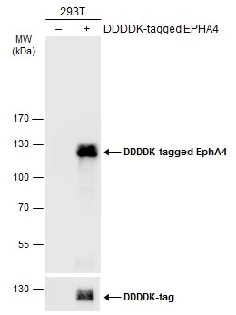 Non-transfected (–) and transfected (+) 293T whole cell extracts (30 μg) were separated by 7.5% SDS-PAGE, and the membrane was blotted with EphA4 antibody [N3C2], Internal (GTX104109) diluted at 1:5000. The HRP-conjugated anti-rabbit IgG antibody (GTX213110-01) was used to detect the primary antibody.