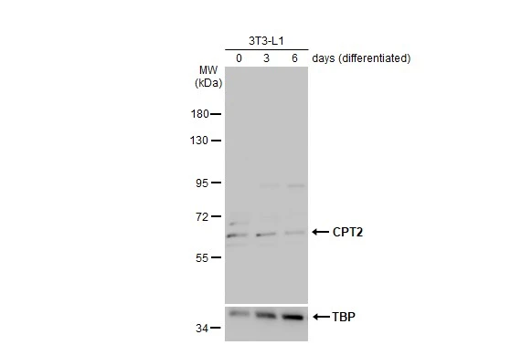 Various whole cell extracts (30 μg) were separated by 7.5% SDS-PAGE, and the membrane was blotted with CPT2 antibody [N1C1] (GTX104115) diluted at 1:1000. The HRP-conjugated anti-rabbit IgG antibody (GTX213110-01) was used to detect the primary antibody.