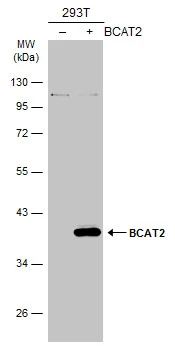 Non-transfected (–) and transfected (+) 293T whole cell extracts (30 μg) were separated by 10% SDS-PAGE, and the membrane was blotted with BCAT2 antibody (GTX104121) diluted at 1:1000. The HRP-conjugated anti-rabbit IgG antibody (GTX213110-01) was used to detect the primary antibody. Non-transfected (–) and transfected (+) 293T whole cell extracts (30 μg) were separated by 10% SDS-PAGE, and the membrane was blotted with BCAT2 antibody (GTX104121) diluted at 1:1000. The HRP-conjugated anti-rabbit IgG antibody (GTX213110-01) was used to detect the primary antibody.