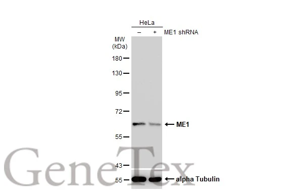 Non-transfected (–) and transfected (+) HeLa whole cell extracts (30 μg) were separated by 7.5% SDS-PAGE, and the membrane was blotted with ME1 antibody (GTX104122) diluted at 1:1000. The HRP-conjugated anti-rabbit IgG antibody (GTX213110-01) was used to detect the primary antibody.