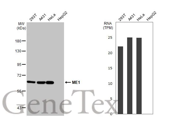 Various whole cell extracts (30 μg) were separated by 7.5% SDS-PAGE, and the membrane was blotted with ME1 antibody (GTX104122) diluted at 1:1000. The HRP-conjugated anti-rabbit IgG antibody (GTX213110-01) was used to detect the primary antibody. Corresponding RNA expression data for the same cell lines are based on Human Protein Atlas program.