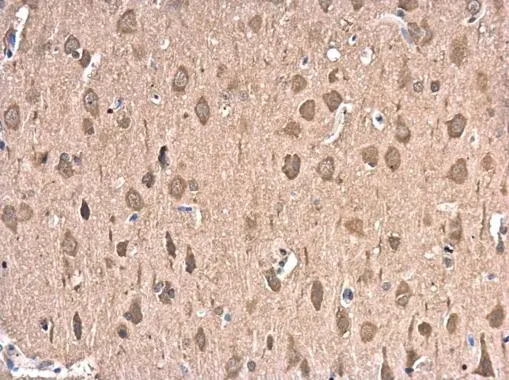HSP70 1A antibody detects HSP70 1A protein at cytoplasm in rat brain by immunohistochemical analysis. Sample: Paraffin-embedded rat brain. HSP70 1A antibody (GTX104126) diluted at 1:500. 
 Antigen Retrieval: Citrate buffer, pH 6.0, 15 min