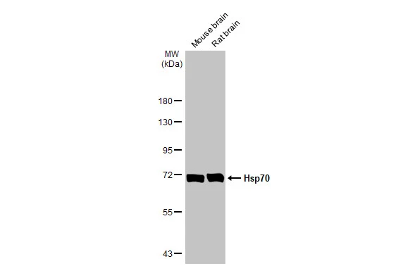 Various tissue extracts (50 μg) were separated by 7.5% SDS-PAGE, and the membrane was blotted with Hsp70 antibody (GTX104126) diluted at 1:1000. The HRP-conjugated anti-rabbit IgG antibody (GTX213110-01) was used to detect the primary antibody.