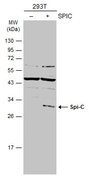 Non-transfected (�) and transfected (+) 293T whole cell extracts (30 ug) were separated by 12% SDS-PAGE,and the membrane was blotted with Spi-C antibody (GTX104182) diluted at 1:500.