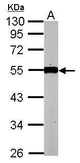 Sample (50 ug of whole cell lysate) A: mouse kidney 10% SDS PAGE GTX104232 diluted at 1:1000