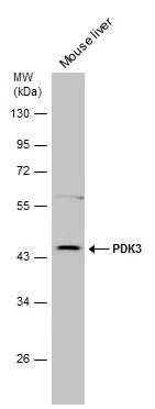 Mouse tissue extract (50 μg) was separated by 10% SDS-PAGE, and the membrane was blotted with PDK3 antibody [N1C2] (GTX104286) diluted at 1:500. The HRP-conjugated anti-rabbit IgG antibody (GTX213110-01) was used to detect the primary antibody.