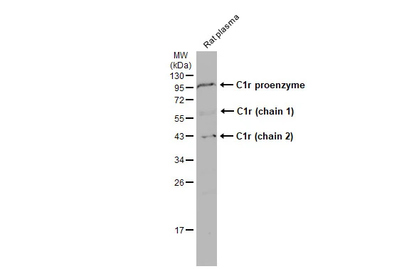 Rat plasma (50 μg) was separated by 12% SDS-PAGE, and the membrane was blotted with C1r antibody (GTX104350) diluted at 1:500. The HRP-conjugated anti-rabbit IgG antibody (GTX213110-01) was used to detect the primary antibody.