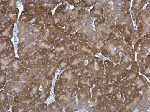 Proteasome 20S alpha 1 antibody [N1C3] detects Proteasome 20S alpha 1 protein at cytoplasm in rat pancreas by immunohistochemical analysis. Sample: Paraffin-embedded rat pancreas. Proteasome 20S alpha 1 antibody [N1C3] (GTX104373) diluted at 1:500. 
 Antigen Retrieval: Citrate buffer, pH 6.0, 15 min