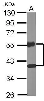 Sample (20 ug of whole cell lysate) A: Mouse brain 10% SDS PAGE GTX104383 diluted at 1:10000