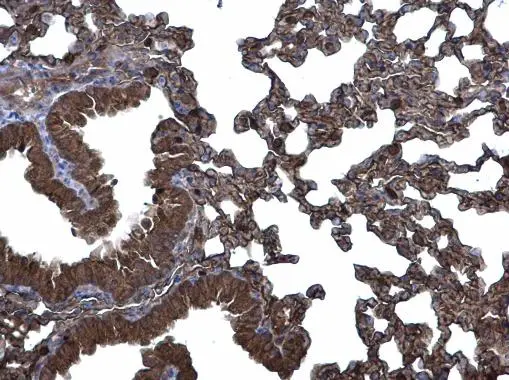 CLIC3 antibody [N1C3] detects CLIC3 protein at membrane and cytoplasm on mouse lung by immunohistochemical analysis. Sample: Paraffin-embedded mouse lung. CLIC3 antibody [N1C3] (GTX104397) diluted at 1:500. 
 Antigen Retrieval: Trilogy? (EDTA based, pH 8.0) buffer, 15min