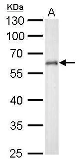 CYP1B1 antibody detects CYP1B1 protein by western blot analysis. A. 50 μg mouse lung lysate/extract 7.5% SDS-PAGE CYP1B1 antibody (GTX104424) dilution: 1:1000 The HRP-conjugated anti-rabbit IgG antibody (GTX213110-01) was used to detect the primary antibody. CYP1B1 antibody detects CYP1B1 protein by western blot analysis. A. 50 μg mouse lung lysate/extract 7.5% SDS-PAGE CYP1B1 antibody (GTX104424) dilution: 1:1000 The HRP-conjugated anti-rabbit IgG antibody (GTX213110-01) was used to detect the primary antibody.
