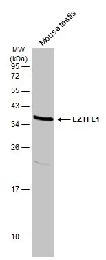 Mouse tissue extract (50 μg) was separated by 12% SDS-PAGE, and the membrane was blotted with LZTFL1 antibody [N1C3] (GTX104469) diluted at 1:1000. The HRP-conjugated anti-rabbit IgG antibody (GTX213110-01) was used to detect the primary antibody.