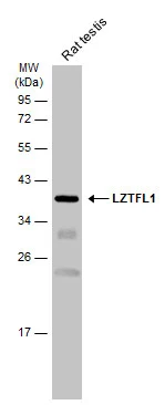 Rat tissue extract (50 μg) was separated by 12% SDS-PAGE, and the membrane was blotted with LZTFL1 antibody [N1C3] (GTX104469) diluted at 1:1000. The HRP-conjugated anti-rabbit IgG antibody (GTX213110-01) was used to detect the primary antibody.