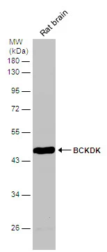 Rat tissue extract (50 μg) was separated by 10% SDS-PAGE, and the membrane was blotted with BCKDK antibody [N2C3] (GTX104477) diluted at 1:10000. The HRP-conjugated anti-rabbit IgG antibody (GTX213110-01) was used to detect the primary antibody.