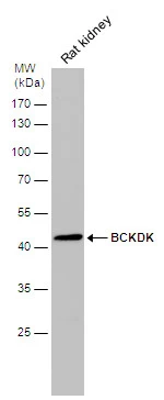 Rat tissue extract (50 μg) was separated by 10% SDS-PAGE, and the membrane was blotted with BCKDK antibody [N2C3] (GTX104477) diluted at 1:10000. The HRP-conjugated anti-rabbit IgG antibody (GTX213110-01) was used to detect the primary antibody.