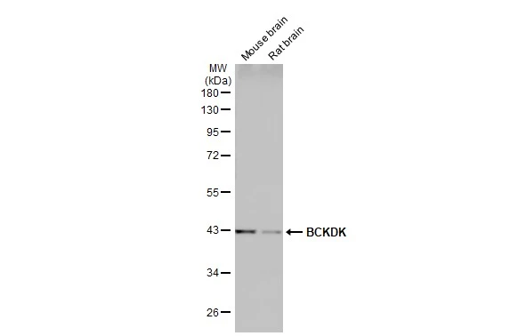 Various tissue extracts (50 μg) were separated by 10% SDS-PAGE, and the membrane was blotted with BCKDK antibody [N2C3] (GTX104477) diluted at 1:10000. The HRP-conjugated anti-rabbit IgG antibody (GTX213110-01) was used to detect the primary antibody, and the signal was developed with Trident ECL plus-Enhanced.