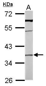 Sample (50 ug of whole cell lysate) A: mouse liver 10% SDS PAGE GTX104486 diluted at 1:1000