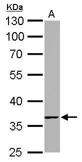 TMEM59 antibody detects TMEM59 protein by Western blot analysis. A. 50 μg rat kidney lysate/extract 10 % SDS-PAGE TMEM59 antibody (GTX104486) dilution: 1:1000