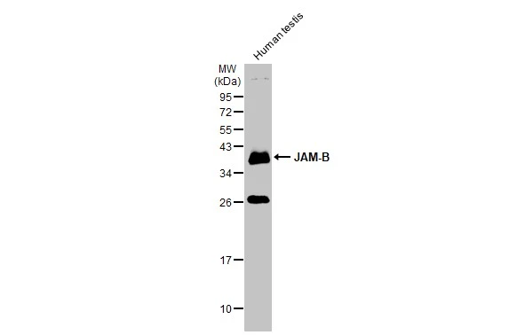 Human tissue extract (30 μg) was separated by 12% SDS-PAGE, and the membrane was blotted with JAM-B antibody (GTX104507) diluted at 1:500. The HRP-conjugated anti-rabbit IgG antibody (GTX213110-01) was used to detect the primary antibody. Human tissue extract (30 μg) was separated by 12% SDS-PAGE, and the membrane was blotted with JAM-B antibody (GTX104507) diluted at 1:500. The HRP-conjugated anti-rabbit IgG antibody (GTX213110-01) was used to detect the primary antibody.